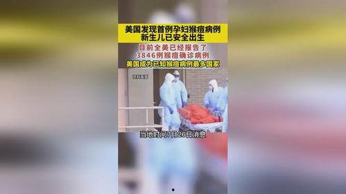 美国猴痘爆料新闻报道视频,最新爆料新闻报道视频揭秘  第1张